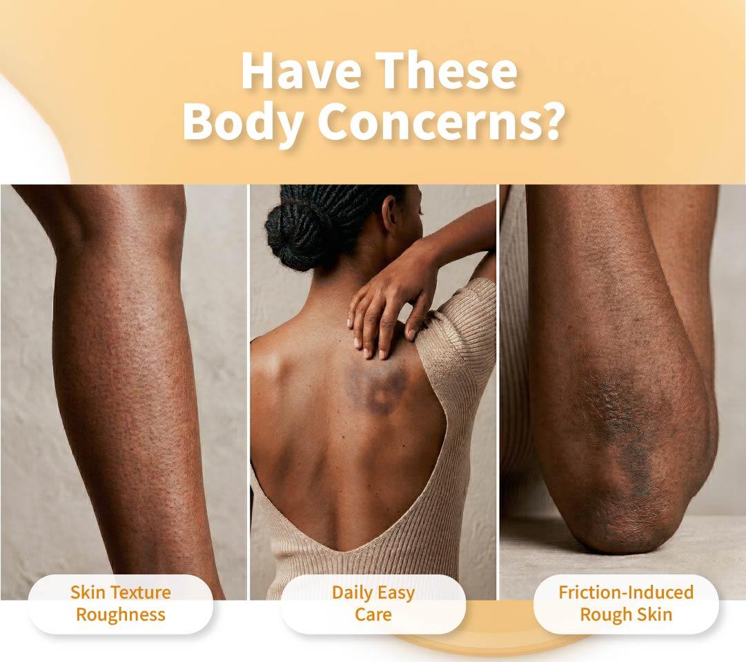 Common body skin concerns