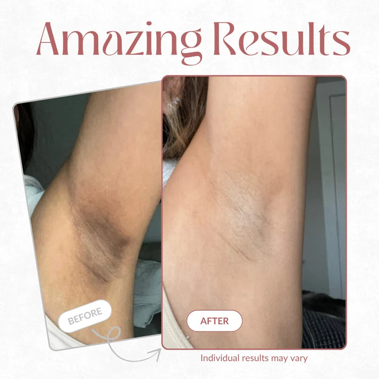 Body care before and after example