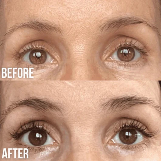 Velmiorae eyelash serum before and after